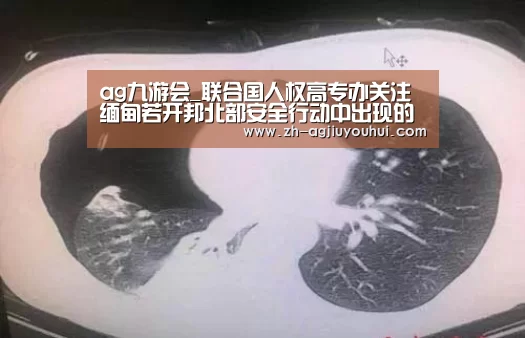 ag九游会_联合国人权高专办关注缅甸若开邦北部安全行动中出现的严重侵犯人权指称(图2) ag九游会